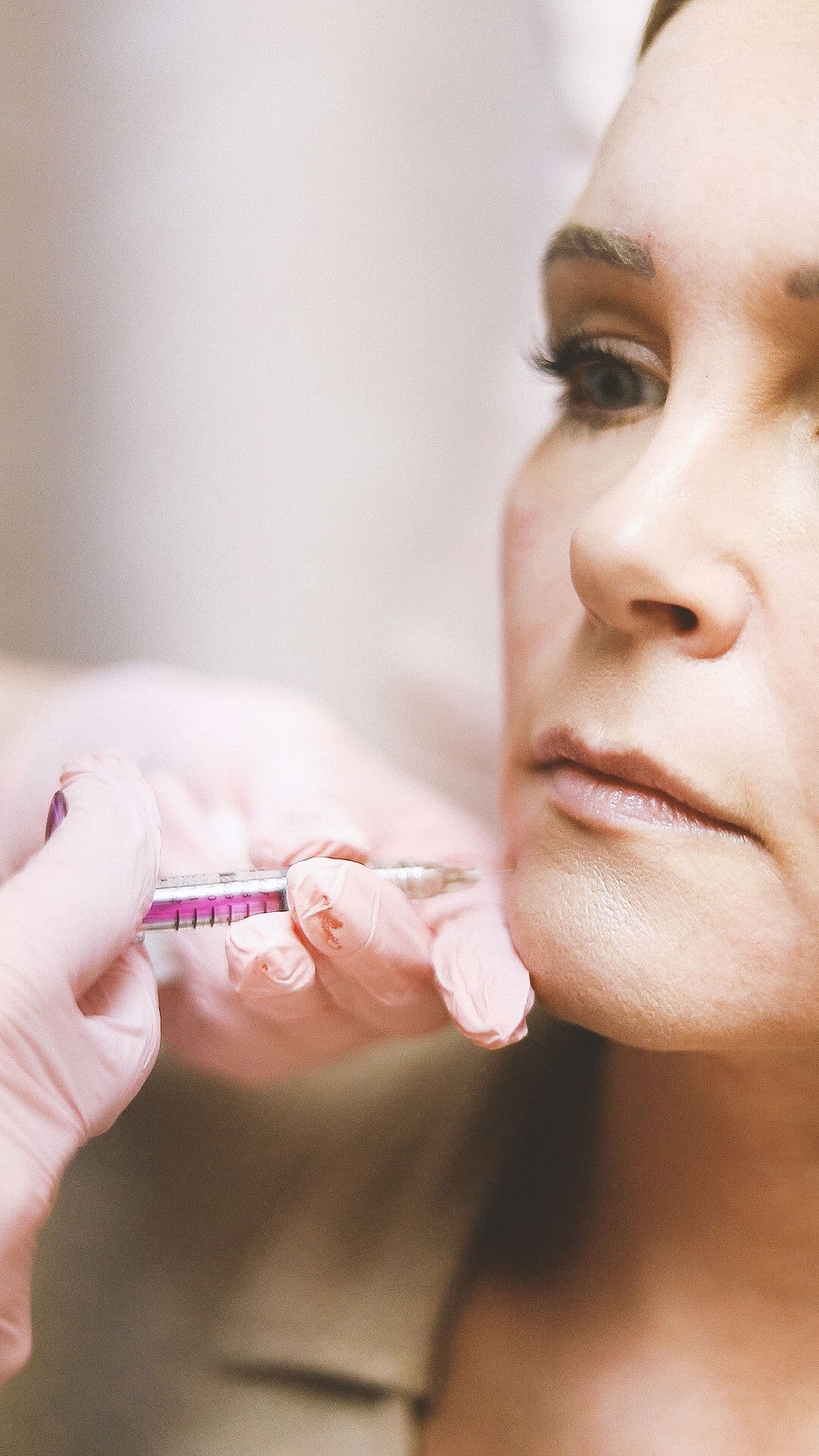 A tasteful dermal filler treatment