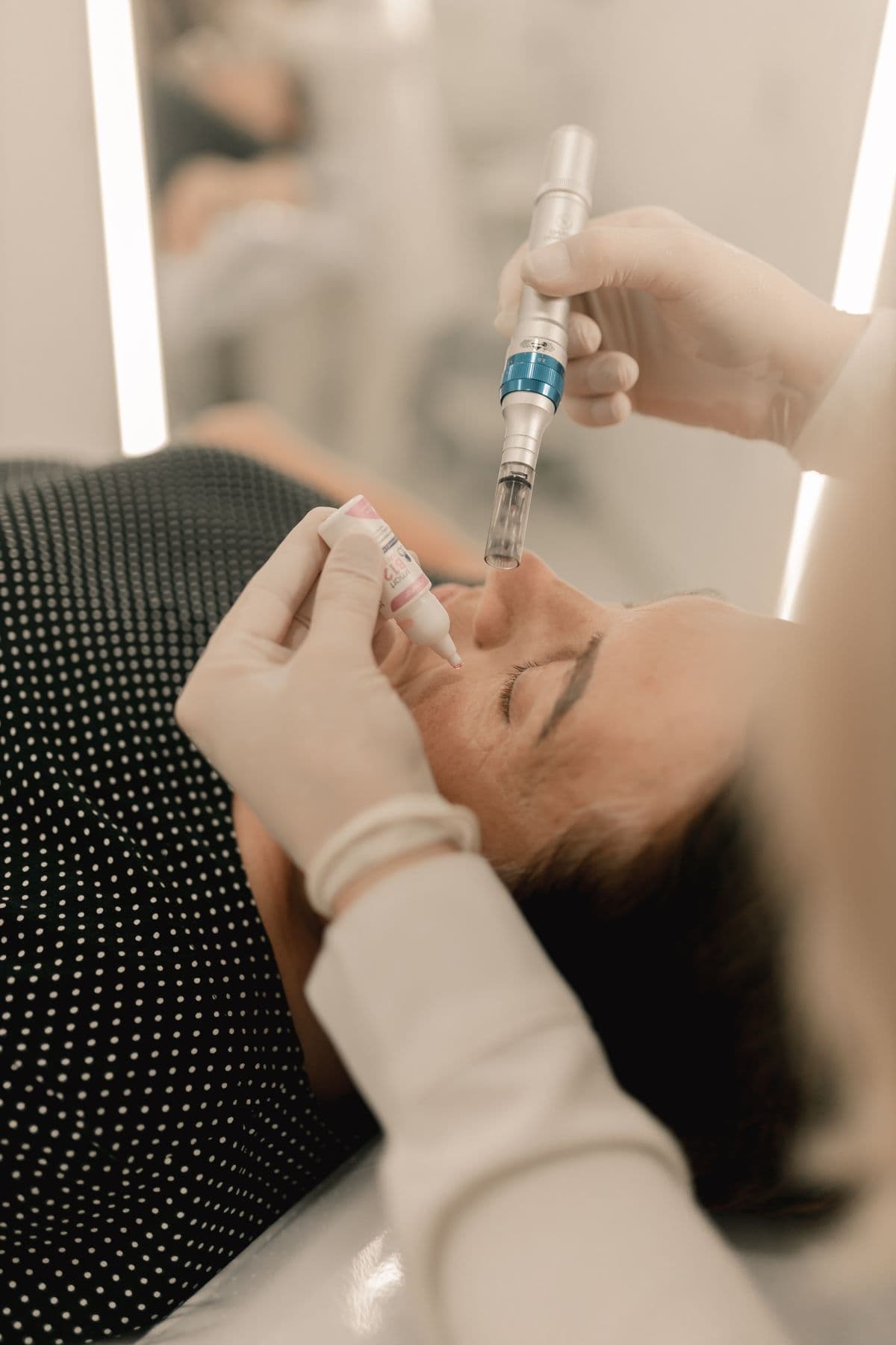 A gentle microneedling skin treatment